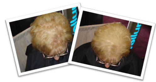 Blonde Hair Before & After